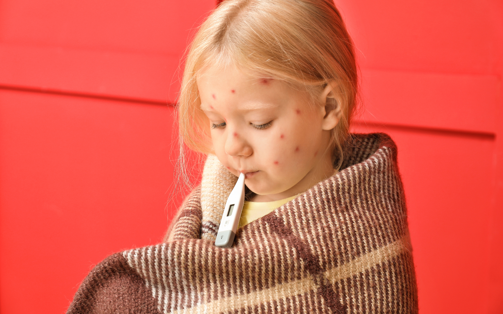 AOK rät zur Windpocken-Impfung